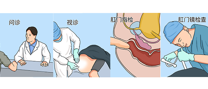 肛肠科