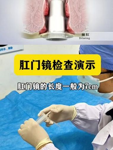 今天给大家看看肛门镜是如何做检查的 苏州肛肠科杨博士 苏州肛肠科